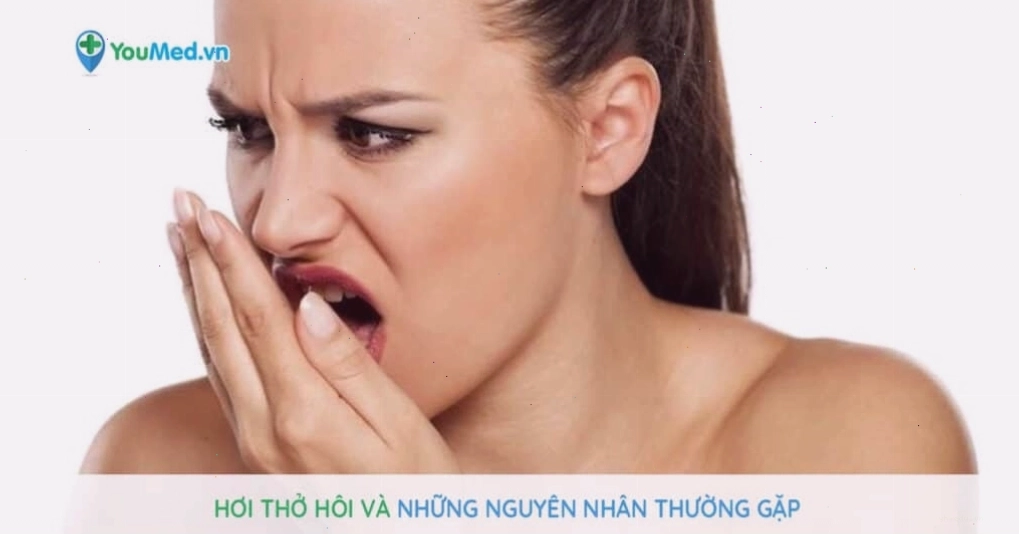 Hơi thở hôi thường đi kèm với tình trạng tích tụ vi khuẩn trên lưỡi