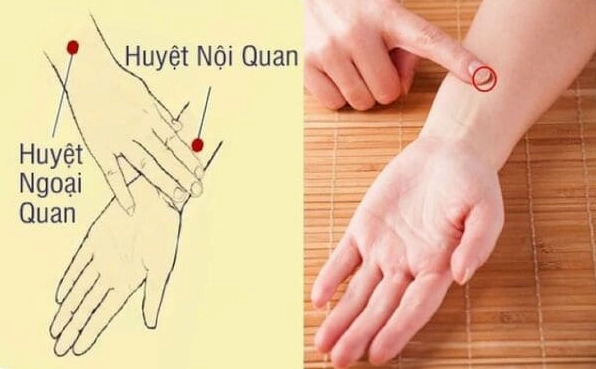 Huyệt nội quan chữa bệnh gì và vị trí chính xác trên cơ thể