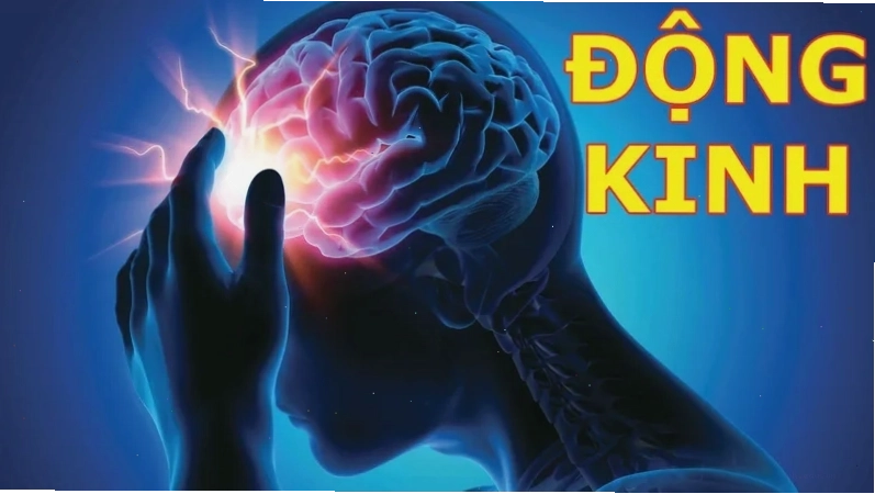 Infographic tổng quan về bệnh động kinh