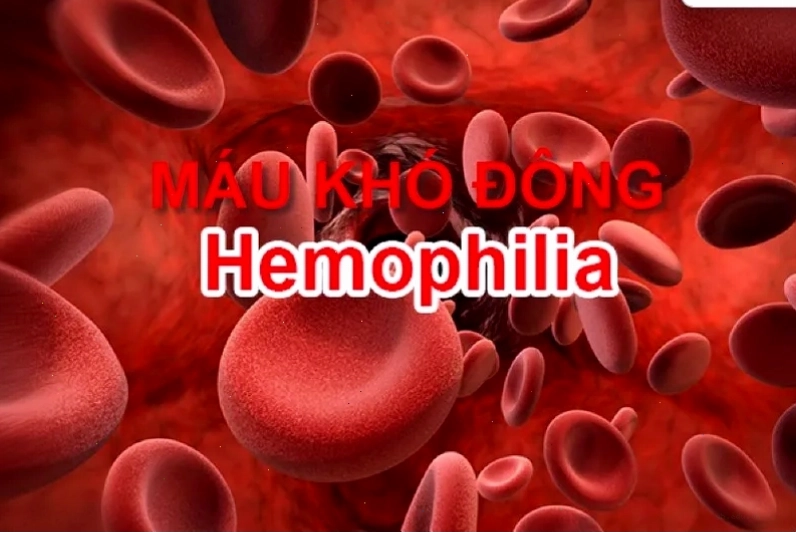 Khái niệm cơ bản về bệnh máu khó đông