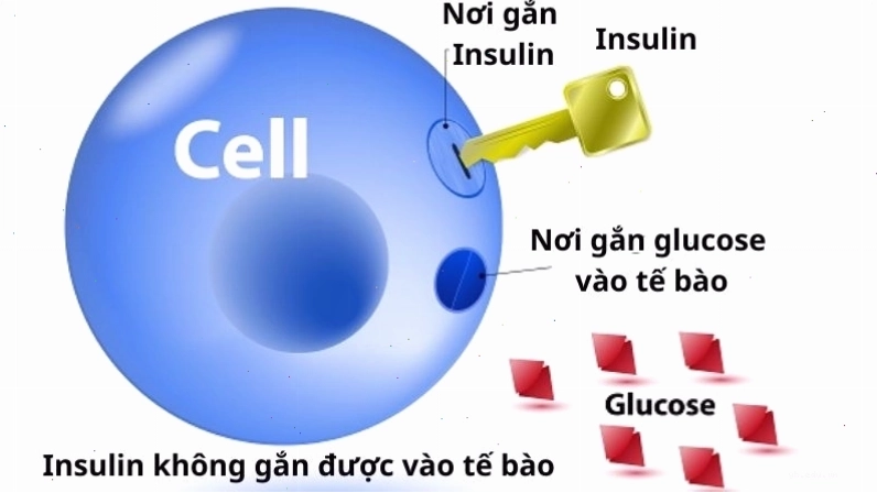 Kháng insulin là nguyên nhân phổ biến gây bệnh gai đen