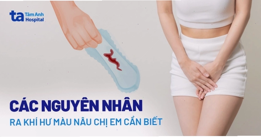 Khí hư có màu nâu đậm bất thường