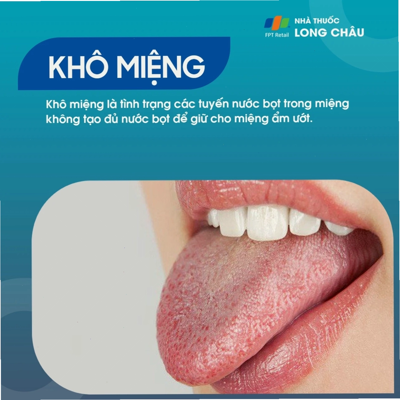 Khô miệng giai đoạn sớm