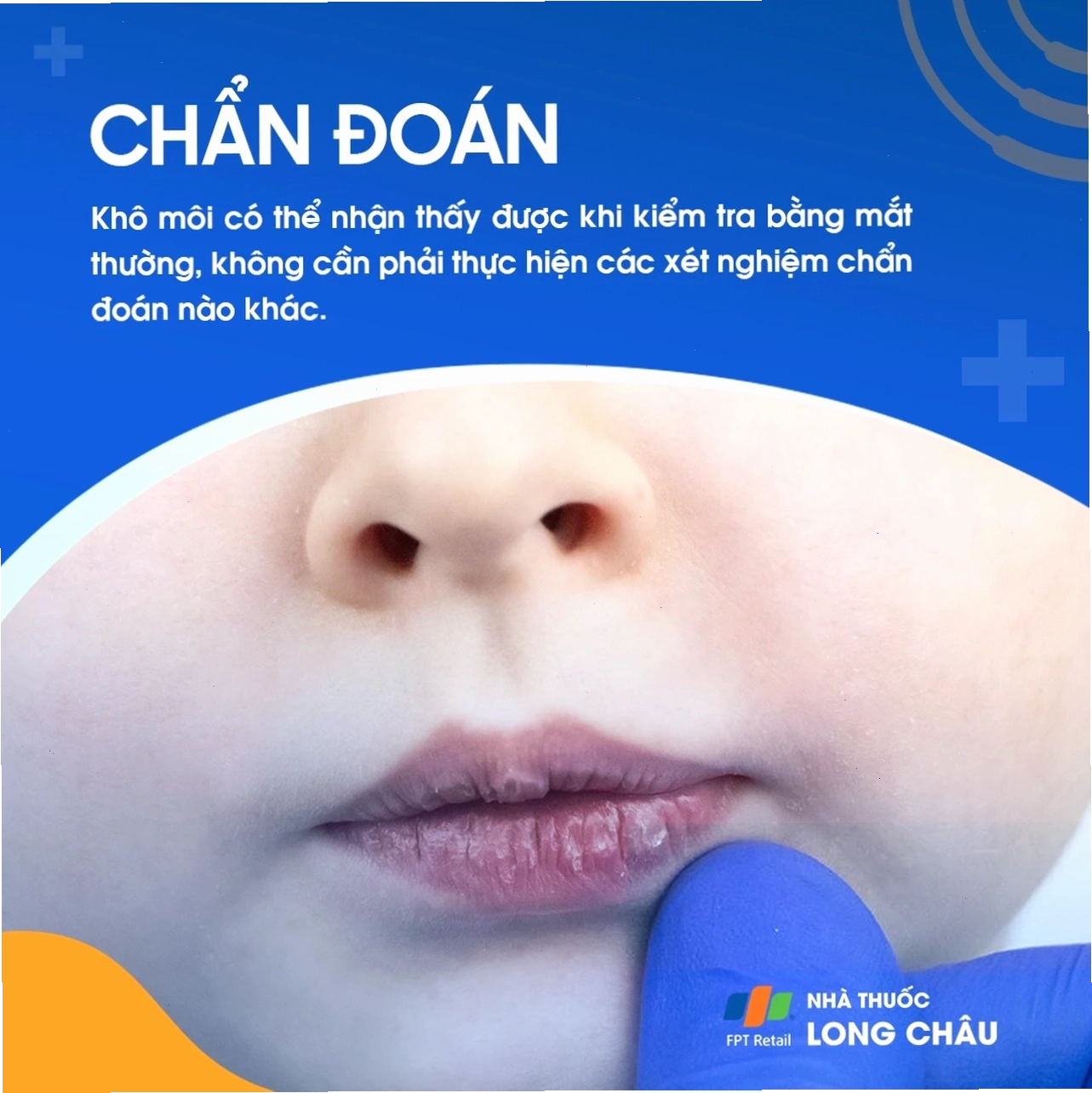 Kiểm tra tình trạng khô môi tại phòng khám da liễu