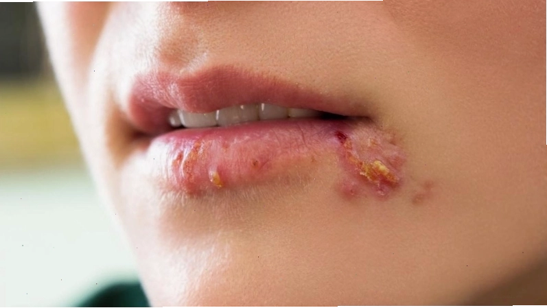Kiến thức sức khỏe