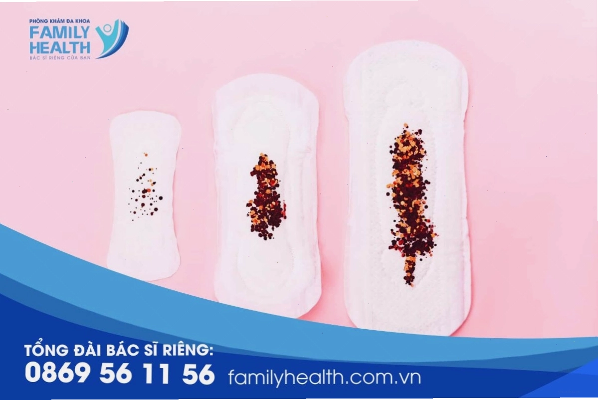 Kinh nguyệt màu đen: Khi nào cần gặp bác sĩ?