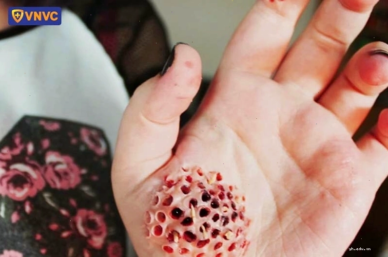 Ký sinh trùng gây bệnh