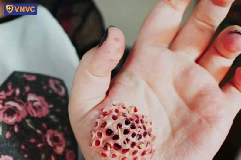 Ký sinh trùng là tác nhân gây nên nhiều bệnh lý