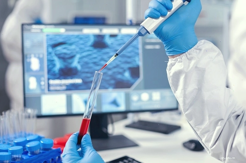 Kỹ thuật ELISA thực hiện xét nghiệm Toxocara IgG để chẩn đoán nhiễm giun