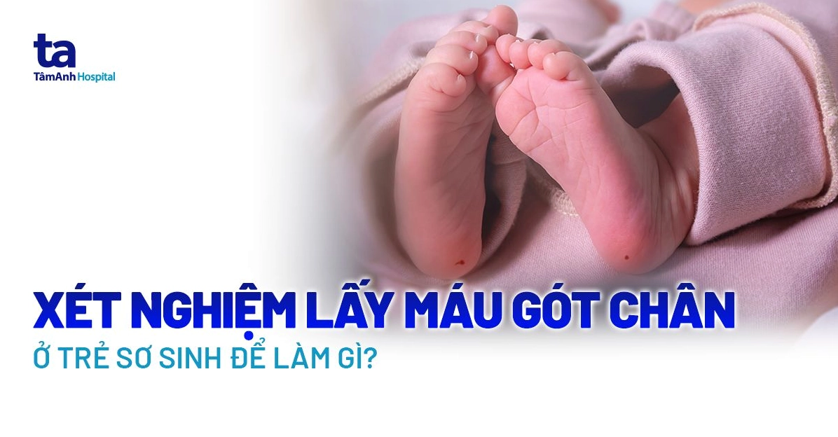 Lấy máu gót chân sàng lọc 6 bệnh gì và những thông tin cha mẹ cần biết