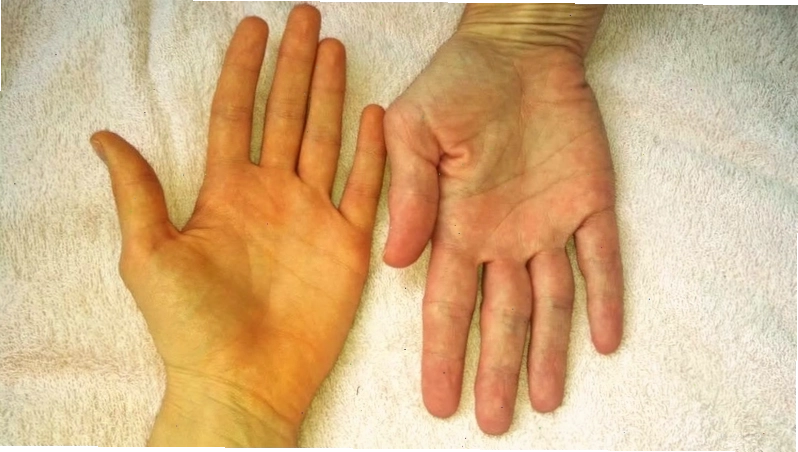 Lối sống lành mạnh giúp phòng ngừa vàng da