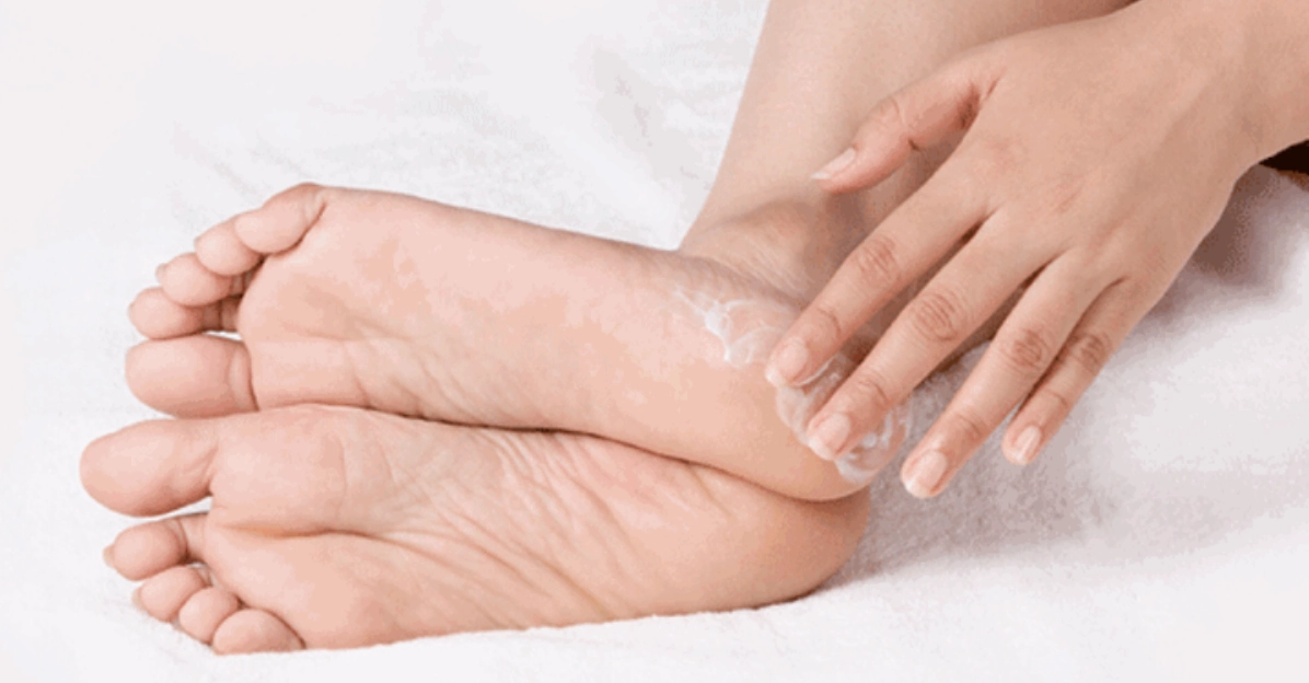 Lòng bàn chân bị tróc da là bệnh gì và cách xử lý theo khoa học