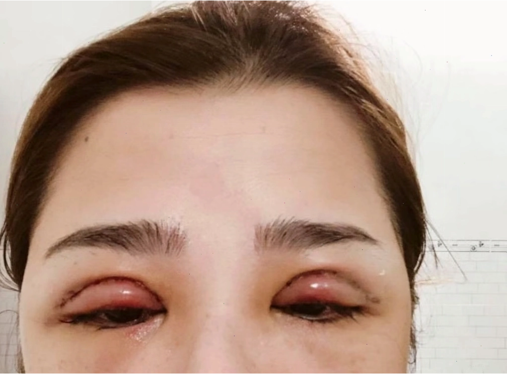 Luôn ưu tiên tìm đến chuyên gia y tế khi bệnh kéo dài