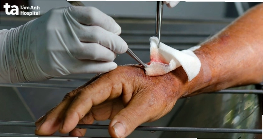 Lưu ý quan trọng khi chăm sóc sau điều trị