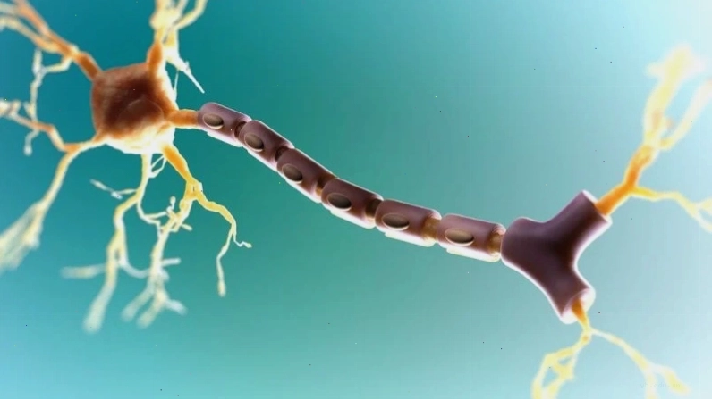 Mất các sợi bao Myelin là nguyên nhân của bệnh đa xơ cứng