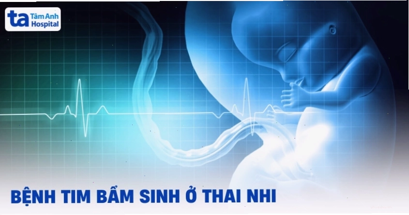 Minh họa bác sĩ đang tư vấn về bệnh tim bẩm sinh cho phụ nữ mang thai