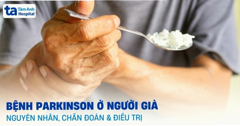 Minh họa bệnh Parkinson ở người già và các biến chứng