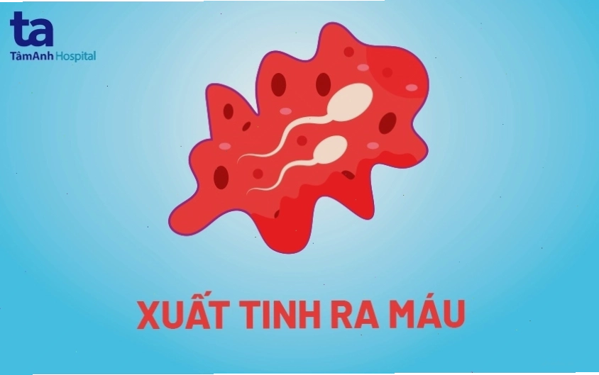 Minh họa các câu hỏi thường gặp về tình trạng xuất tinh ra máu