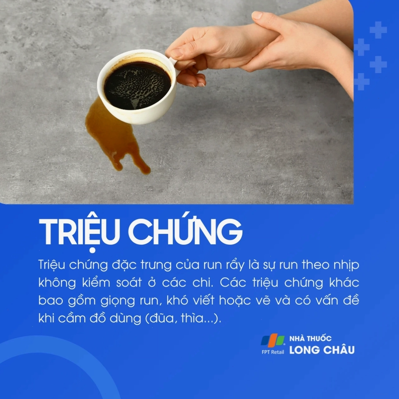 Minh họa các mức độ run rẩy khác nhau