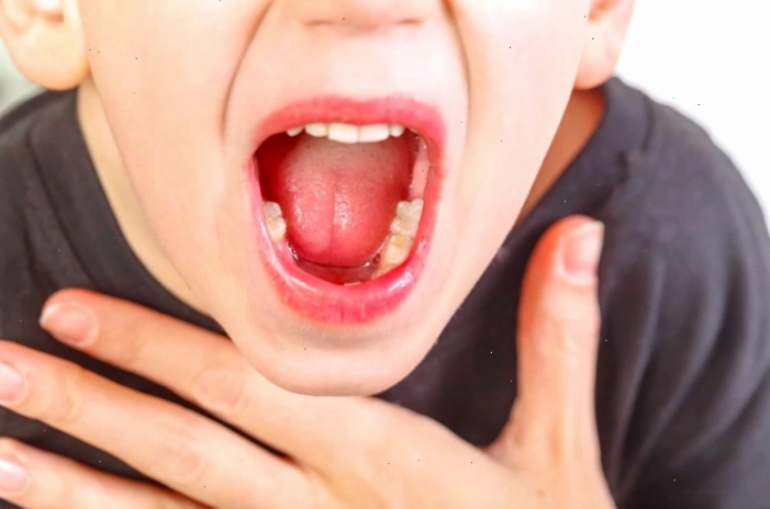 Minh họa cảm giác nghẹn cổ họng nhưng ăn uống bình thường