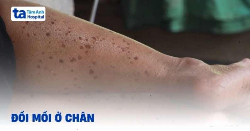 Minh họa chăm sóc da chân khỏe mạnh