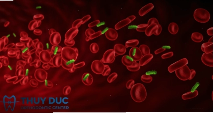 Minh họa cơ chế bệnh lý liên quan đến tăng ure máu ảnh hưởng sức khỏe toàn thân