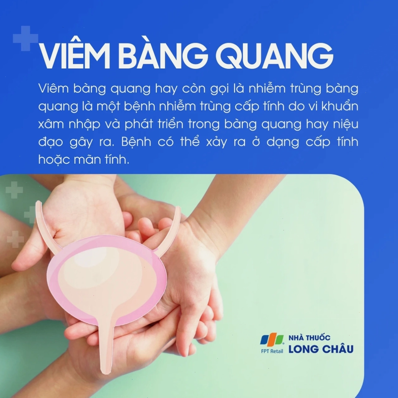 Minh họa cơ chế gây viêm bàng quang