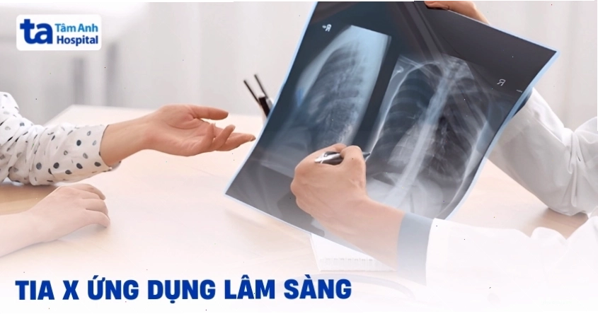 Minh họa cơ chế hoạt động của tia X trong chẩn đoán