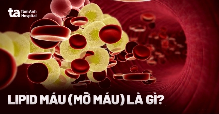 Minh họa cơ chế mỡ máu