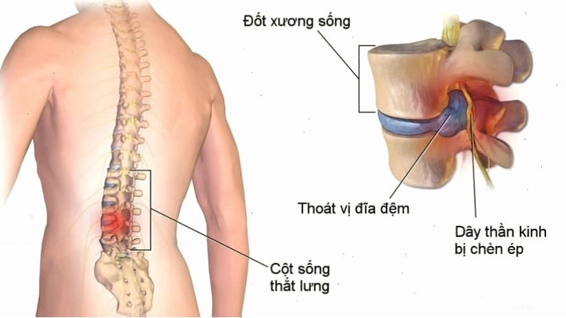 Minh họa kiểm tra cột sống