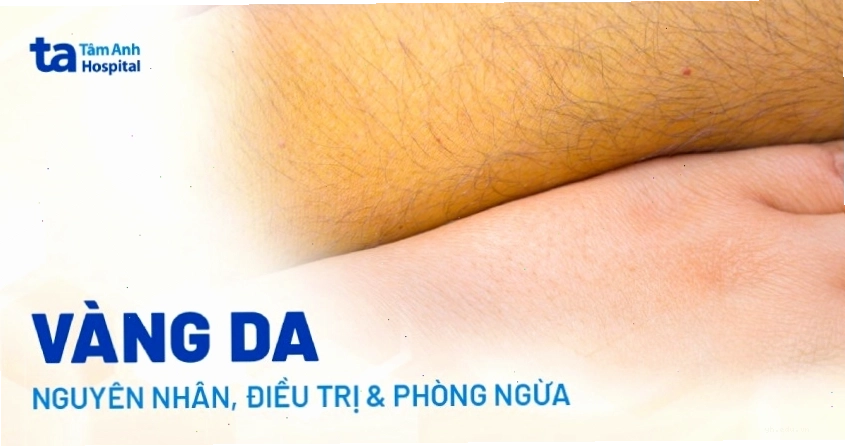 Minh họa lối sống lành mạnh giúp gan khỏe mạnh