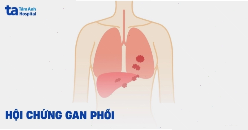 Minh họa lối sống lành mạnh