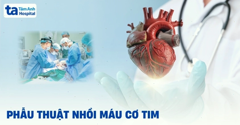 Minh họa phẫu thuật nhồi máu cơ tim
