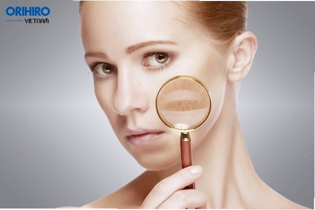 Minh họa tình trạng da mất đi sự đàn hồi tự nhiên