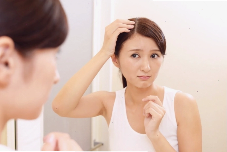 Minh họa tình trạng lông mày bị rụng thưa thớt ở người trưởng thành