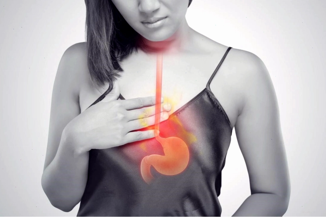 Minh họa tình trạng người bệnh bị ợ nóng khó chịu