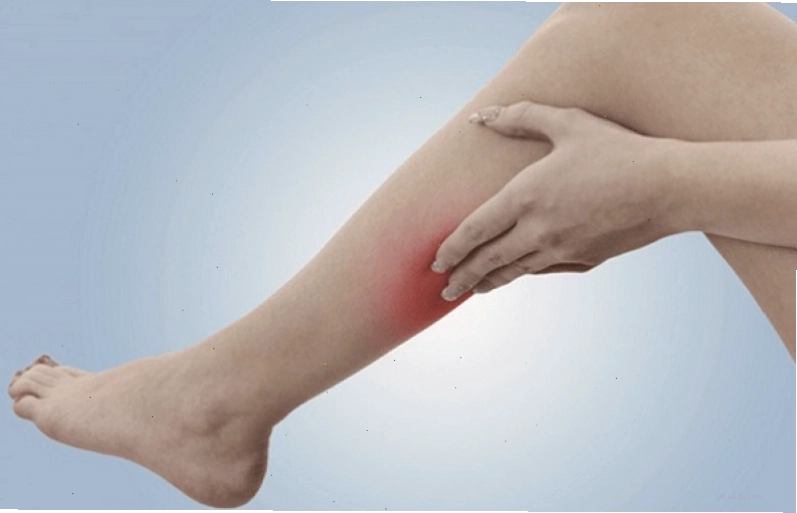 Minh họa tình trạng tê bắp chân thường gặp