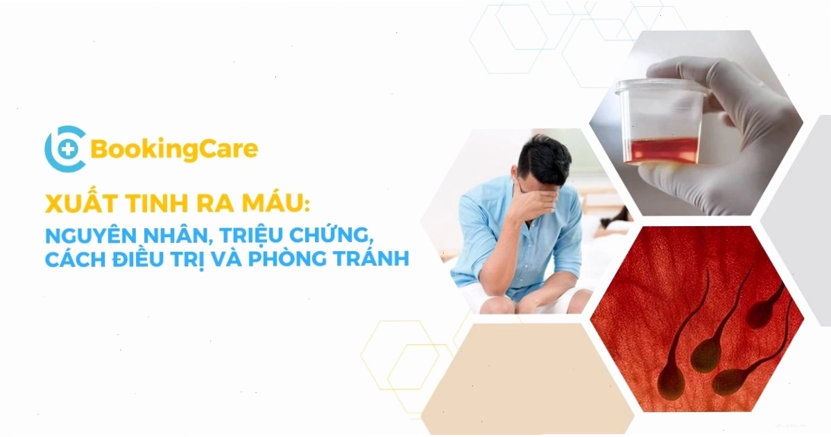 Minh họa tổng quát về việc chăm sóc sức khỏe nam khoa