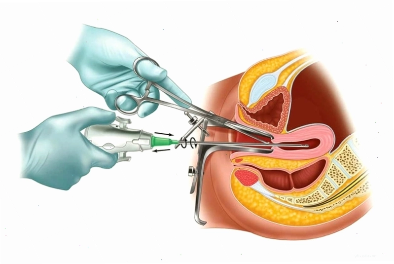 Minh họa tư vấn sức khỏe