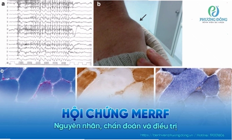 Mô phỏng tổn thương tế bào trong các hội chứng bệnh lý