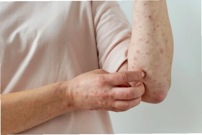 Mô tả các triệu chứng đi kèm khi da tay thâm đen