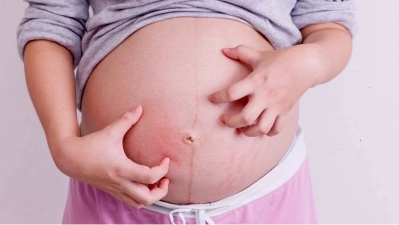 Mô tả tình trạng gan của mẹ bầu không bài tiết mật đúng cách dẫn đến tích tụ muối mật