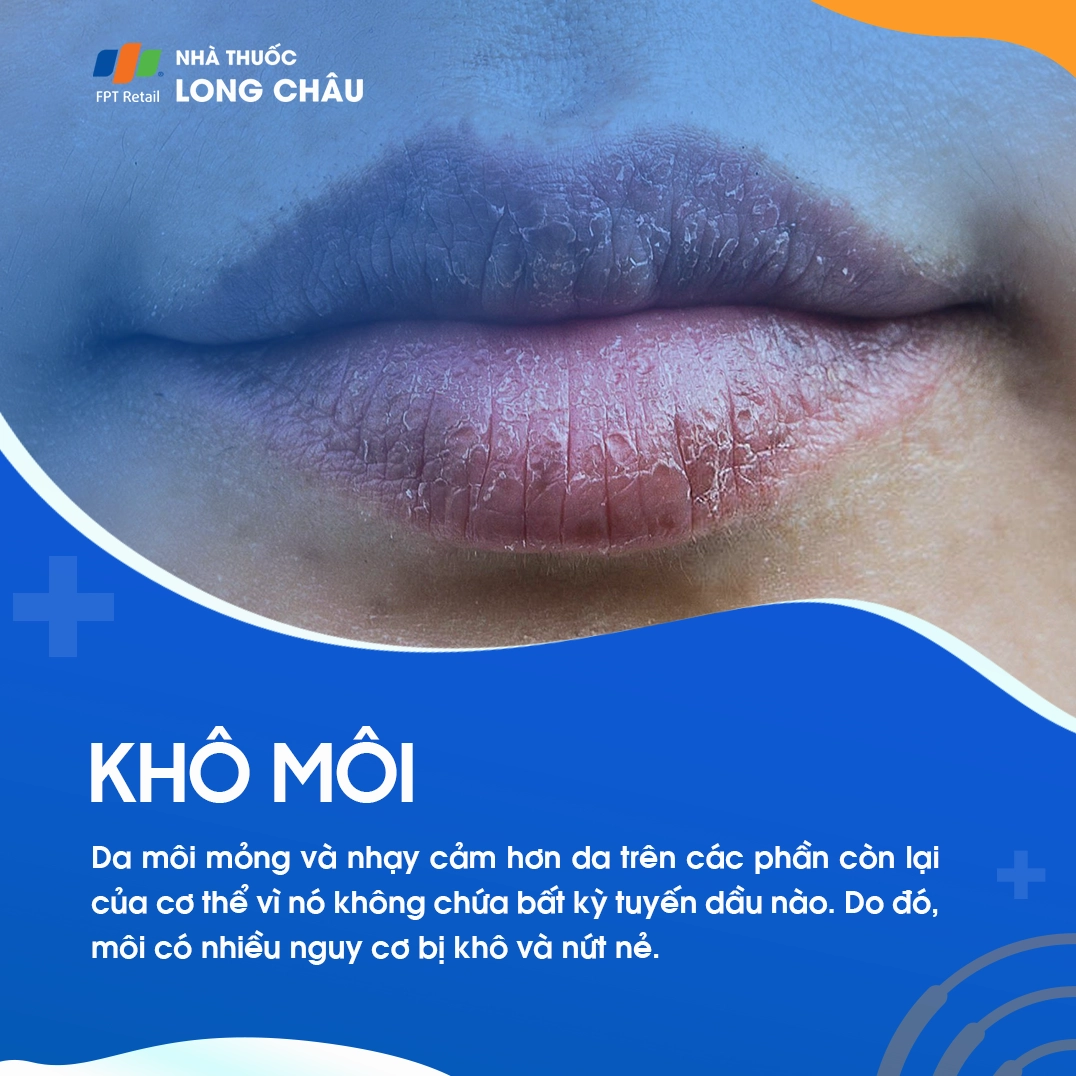 Môi khô bong tróc là bệnh gì và cách nhận biết các dấu hiệu sớm