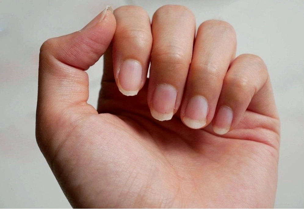 Móng tay có thể phản ánh tình trạng sức khỏe của cơ thể