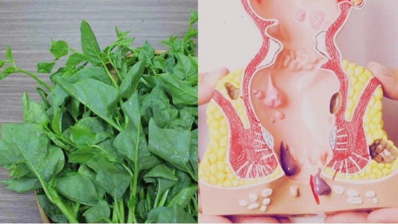 Mồng tơi hỗ trợ trị bệnh trĩ