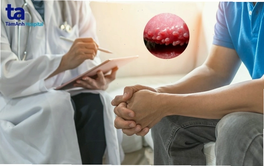 Nên làm gì khi phát hiện chuỗi hạt ngọc dương vật