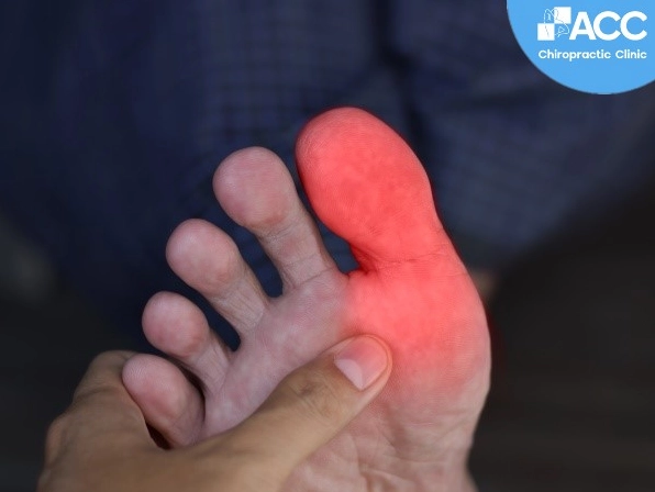Ngón chân cái bên phải bị tê là bệnh gì và cách xử lý hiệu quả