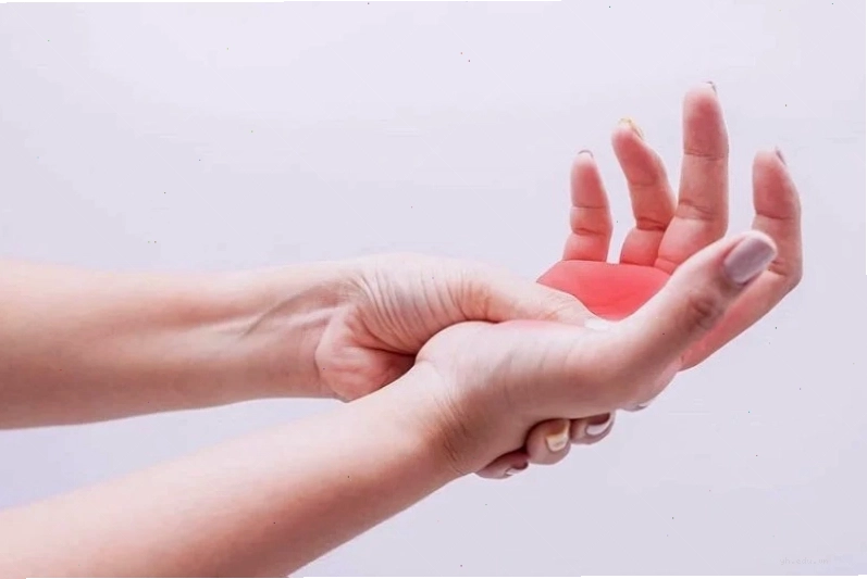 Người bệnh có triệu chứng tê bì môi kèm tê tay chân