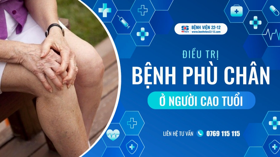 Người già bị phù chân là bệnh gì và giải pháp điều trị hiệu quả