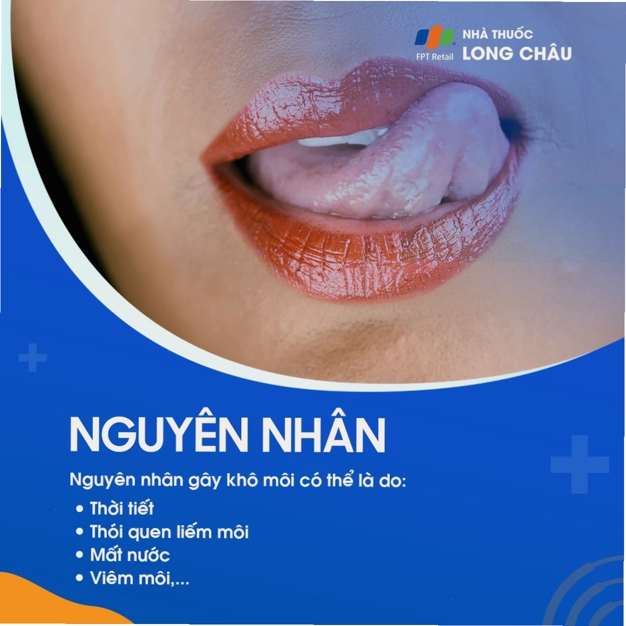 Nguyên nhân gây khô môi có thể do thời tiết lạnh và khô hanh